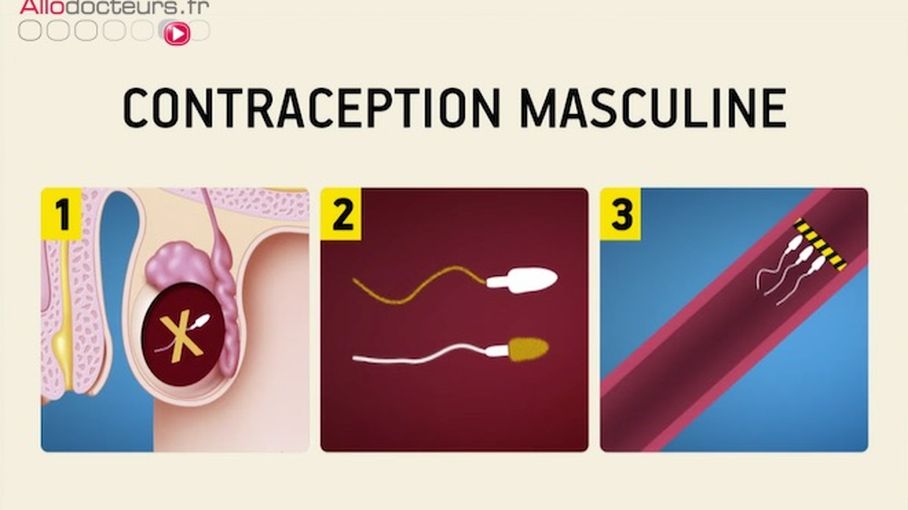 Contraception Masculine O En Est On