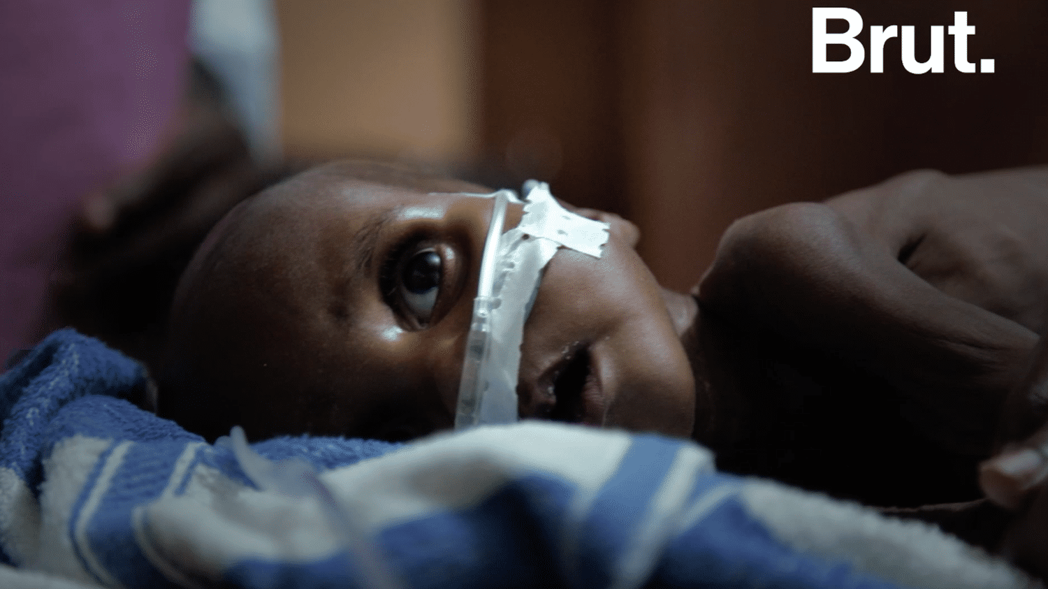 VIDEO Au Tchad des milliers denfants touchés par la malnutrition