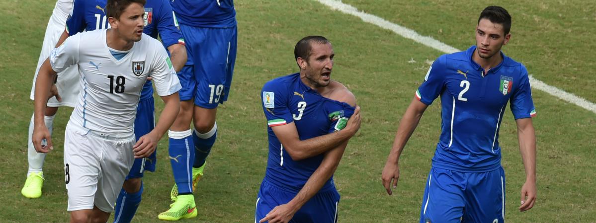 Coupe Du Monde Litalie Sur Les Dents Après Son