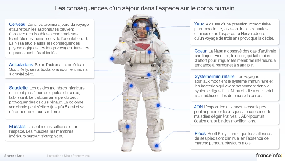 INFOGRAPHIE. Quels Peuvent être Les Effets Du Voyage Dans L'espace Sur ...