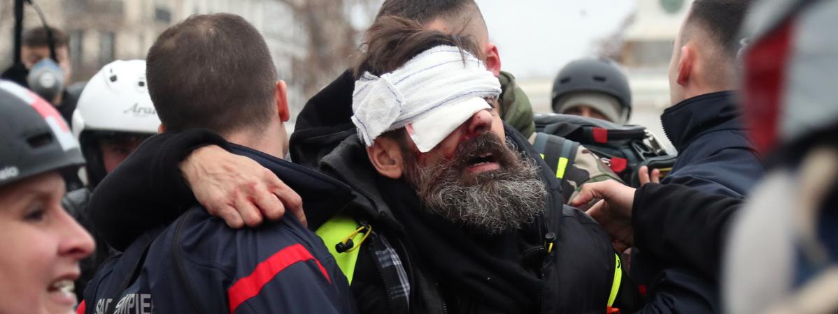 Jérôme Rodrigues Une Des Figures Des Gilets Jaunes Blessé