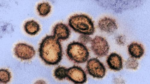 Epidémie de coronavirus : une mutation a-t-elle rendu le Covid-19 plus agressif ?