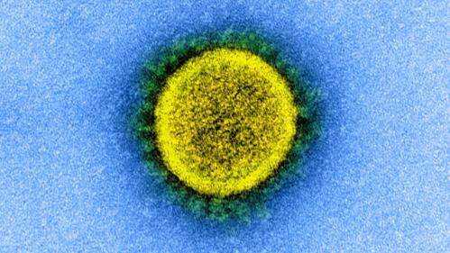 Coronavirus : les questions que vous vous posez sur vos congés pendant le confinement