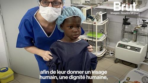 VIDEO. Cette asso redonne un visage aux enfants touchés par la maladie de Noma