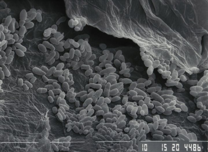 Bactéries à la surface de la couche cornée (microscopie électronique à balayage)
 (L&#039;Oréal)