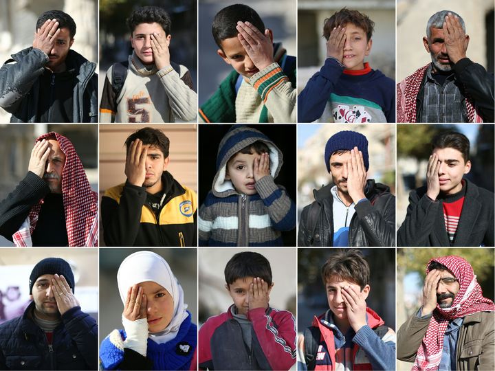 Des habitants de Douma (Syrie)&nbsp;se couvrent un&nbsp;œil en solidarité avec le petit Karim, le 19 décembre 2017.&nbsp; (#SOLIDARITYWITHKARIM CAMPAIGN / AFP)