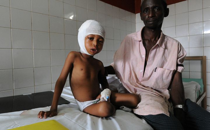 Un p&egrave;re et son fils, bless&eacute; par des coups de machette, dans la nuit du 2 au 3 d&eacute;cembre, &agrave; Boali, dans un h&ocirc;pital de Bangui, en Centrafrique, mercredi 4 d&eacute;cembre 2013.&nbsp; (SIA KAMBOU / AFP)