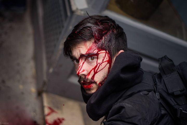 Tuff assure avoir été frappé à la tête et à la cuisse par au moins un CRS lors de la manifestation contre la réforme de la SNCF, mardi 3 avril à Paris. (GRAINE / LAMEUTE)