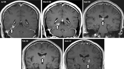 &nbsp; (radiographie d'un cerveau © Maxppp)