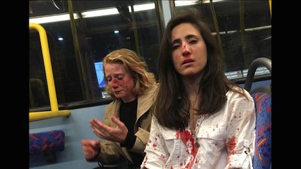 Homophobie : deux lesbiennes agressées pour avoir refusé de s’embrasser en public (Cr&eacute;dits Photo : Capture Ecran Facebook @Melania Ps)