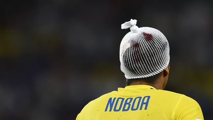 Le milieu &eacute;quatorien Christian Noboa et son filet ensanglant&eacute; sur le t&ecirc;te, le 25 juin &agrave; Rio, face &agrave; la France. Le Suisse&nbsp;Steve Von Bergen &ndash; bless&eacute; &agrave; l'&oelig;il &ndash; et le Nig&eacute;rian Ogenyi Onazi &ndash; touch&eacute; &agrave; la cheville &ndash; peuvent t&eacute;moigner du jeu rugueux des Bleus. (ODD ANDERSEN / AFP)