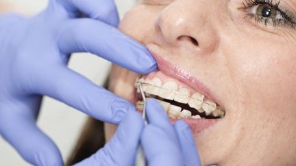 Une femme chez le dentiste (photo d'illustration). (MICROGEN IMAGES / SCIENCE PHOTO LI / SMD)