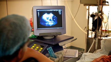 Un praticien surveille l'image donn&eacute;e par une &eacute;chographie endovaginale &agrave; l'h&ocirc;pital Antoine-B&eacute;cl&egrave;re de Clamart (Hauts-de-Seine), le 21 juin 2011. (L. SOUCI / BSIP)