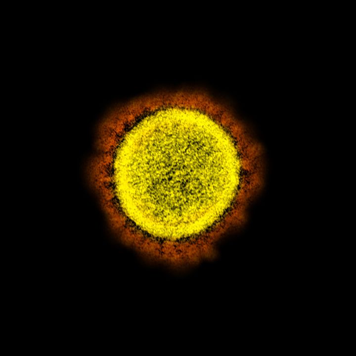 Une représentation au microscope du virus Sars-Cov-2,&nbsp;à l'origine de l'épidémie de Covid-19. (NIAID-NIH / PHANIE)