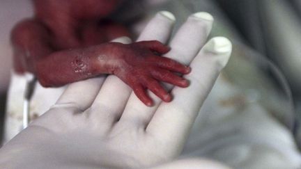 Une infirmi&egrave;re tient la main d'un pr&eacute;matur&eacute; n&eacute; &agrave; cinq mois de grossesse dans un h&ocirc;pital de Medellin (Colombie), le 20 ao&ucirc;t 2014. (FREDY BUILES / REUTERS)