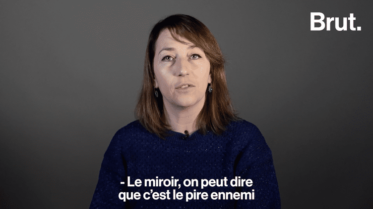 VIDEO. La dermatillomanie, ce TOC qui fait se triturer la peau excessivement