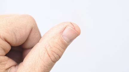 An everyday tragedy: cutting your finger with a sheet of paper (illustrative photo). (AITOR DIAGO / MOMENT RF / VIA GETTY)