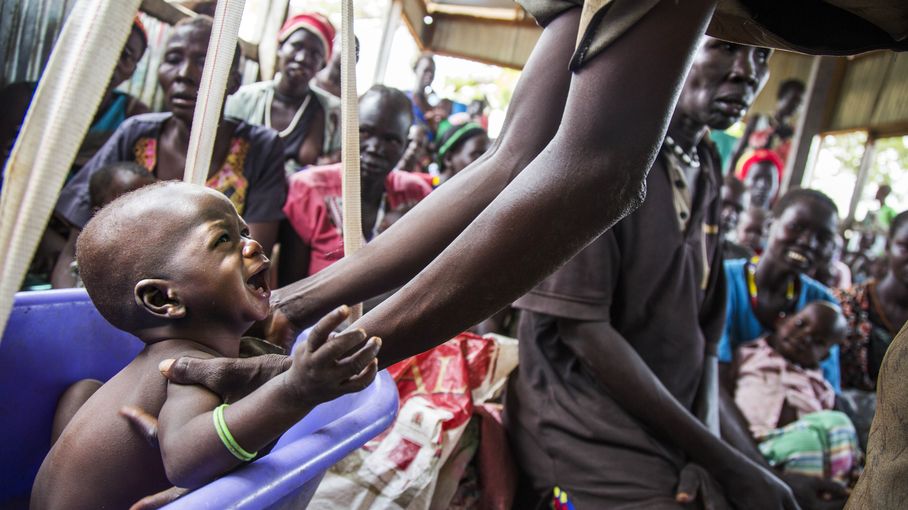 Au Soudan Du Sud, La Moitié De La Population Souffre De Malnutrition