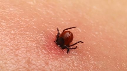 Maladie de Lyme : quelle place pour les tests biologiques ? (&nbsp;- Photo&copy; shishiga - Fotolia.com)