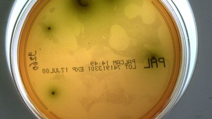 Gros plan d'une souche de listeria pris le 10 mai 2000 au laboratoire d'analyse départementale de la Manche à St-Lo. (MYCHELE DANIAU / AFP)