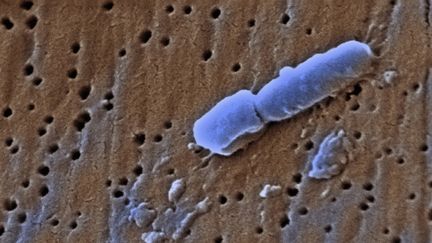 Rare, la Klebsiella pneumoniae est résistantes à quasiment tous les antimicrobiens sur le marché. (CALLISTA IMAGES / CULTURA CREATIVE / AFP)