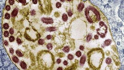 Vue microscopique des particules du vrius de Marburg. ( CDC / MURPHY-WHITFIELD / BSIP)