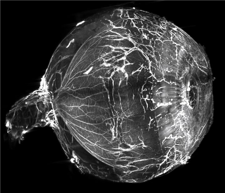 A three-dimensional modeling of the transparent eye, carried out at the Vision Institute in Paris.  (MARY DARCHE)