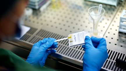 Une analyse de sperme effectuée dans le cadre d'une fécondation in vitro. (L. SOUCI / BSIP / AFP)