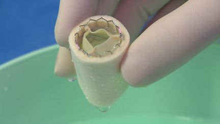 Implants cardiaques, prothèses de hanche : vos questions, nos réponses (2)