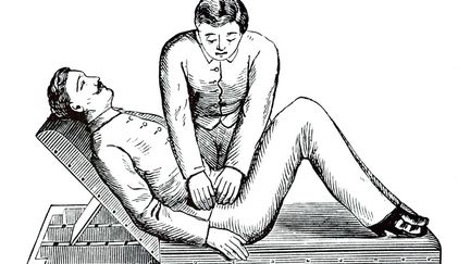 Gravure du XIXe siècle, avec un patient recevant un massage du colon recommandé contre la constipation. Aujourd'hui, on parle d'électrodes qu'on pourrait coller sur la peau. (Illustration) (UNIVERSAL IMAGES GROUP EDITORIAL VIA GETTY IMAGES)