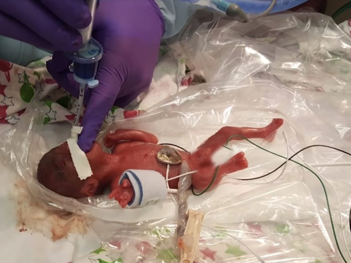 Video Californie Le Plus Petit Bebe Ne En Vie Au Monde Quitte L Hopital Apres Cinq Mois De Soins