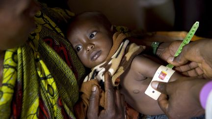 Un m&eacute;decin mesure le bras d'un enfant d'un an dans le nord du Burundi, le 23 septembre 2013. (THOMAS SCHULZE / AFP)