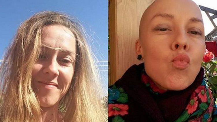 Eggheadchallenge Elles Montrent Leur Crane Chauve Pour Sensibiliser Au Cancer