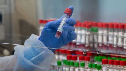 Un technicien de laboratoire manipule un prélèvement réalisé lors d'un test PCR pour le Covid-19 à Mulhouse (Haut-Rhin), le 17 novembre 2020. (PATRICK HERTZOG / AFP)