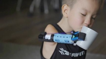 Handicap : une prothèse de bras à partir de Lego