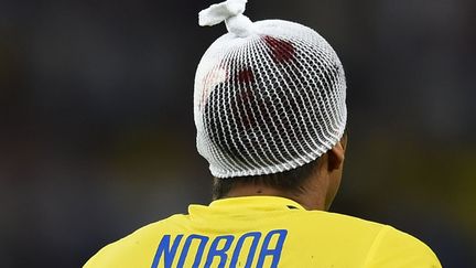 Le milieu de terrain &eacute;quatorien Christian Noba bless&eacute; &agrave; la t&ecirc;te lors du match de Coupe du monde de fottball contre la France &agrave; Rio de Janeiro (Br&eacute;sil), le 25 juin 2014. (ODD ANDERSEN / AFP)