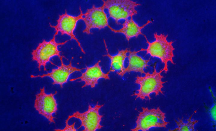 Vue au microscope et fluorescente de cellules souches embryonnaires de souris, prise &agrave; l'Institut de biom&eacute;decine de M&uuml;nster (Allemagne). (MAXPPP)