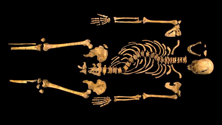 Sur cette photo du squelette de Richard III, apparaissent nettement la scoliose et le cr&acirc;ne fendu au combat. (UNIVERSITY OF LEICESTER / AFP)