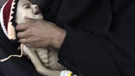 Un enfant souffrant de malnutrition &agrave; l'h&ocirc;pital al-Sabyeen &agrave; Sanaa (Yemen), le 28 mai 2012. (MOHAMED AL-SAYAGHI / REUTERS)