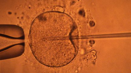 L'injection par pipette d'un spermatozoïde dans un ovocyte pour la formation d'un embryon, réalisée dans un centre d'étude et de conservation des œufs et du sperme (Cecos) à Rennes (Ille-et-Vilaine), le 30 novembre 2000.&nbsp; (MARCEL MOCHET / AFP)