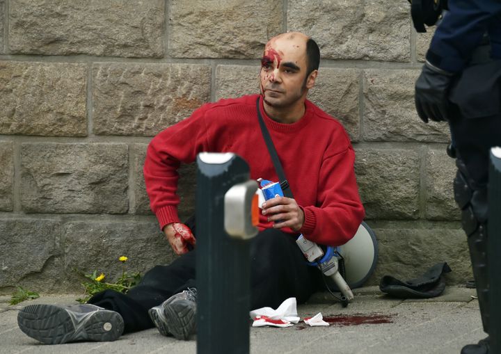 Une homme blessé pendant la manifestation contre la loi Travail, à Nantes, le 24 mars 2016. (LOIC VENANCE / AFP)