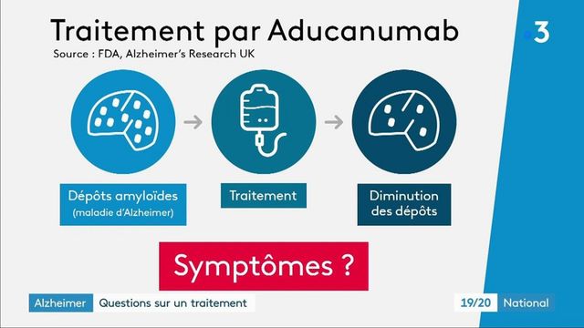 Wissenschaft: Ein vielversprechendes Medikament gegen Alzheimer?