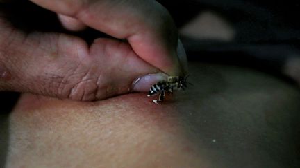 Certains appellent cette technique l'«apipuncture». Les plus formés des apithérapeutes font piquer l'abeille sur les méridiens correspondant à l'organe à soigner, comme en acupuncture. Pour chaque «patient», Omar utilise environ six abeilles qu'il a d'abord enfermées dans un sac en plastique. Six insectes pour six régions du corps différentes, selon les pathologies. Une à deux personnes par semaine se rendent chez lui. Certes, les vertus médicinales de sa technique sont mises en doute par la médecine mais l'apaisement affiché des malades, leurs visites renouvelées et le bouche-à-oreille suffisent, selon Omar, à démontrer son efficacité. (AMR ABDALLAH DALSH / REUTERS)