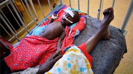 Un b&eacute;b&eacute; somalien en &eacute;tat de malnutrition, le 24 avril 2013 &agrave; Mogadiscio, la capitale de la Somalie.&nbsp; (CARL DE SOUZA / AFP)