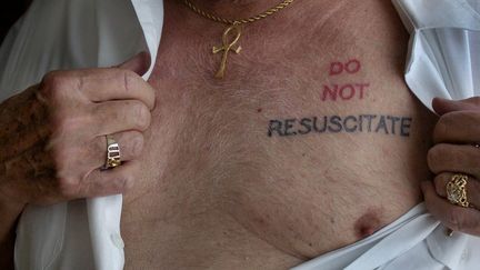 Un médecin australien à la retraite, Albert Cutter, montre son tatouage "ne pas réanimer", le 17 février 2005 à Sydney. (MAXPPP)