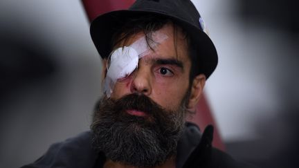 Jérome Rodrigues, l'une des figures du mouvement des "gilets jaunes", lors d'une conférence de presse à l'hôpital Cochin, à Paris, le 27 janvier 2019. (CHRISTOPHE ARCHAMBAULT / AFP)