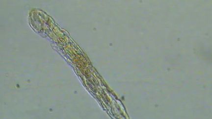 Image du rotifère qui a survécu pendant environ 24&nbsp;000 ans.&nbsp; (CURRENT BIOLOGY / CAPTURE D'ÉCRAN)