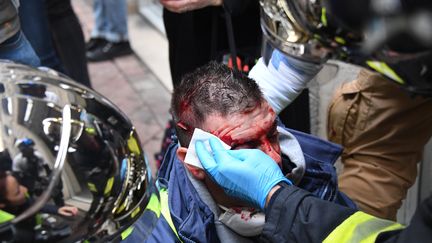 Olivier Béziade, blessé lors d'une manifestation de "gilets jaunes", à Bordeaux, le 12 janvier 2019. (MEHDI FEDOUACH / AFP)