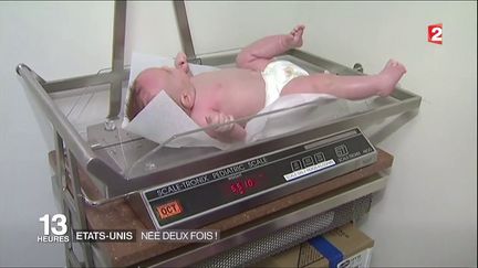 Atteint d'une tumeur et opéré avant la naissance, ce bébé est "né" deux fois. (FRANCE 2)