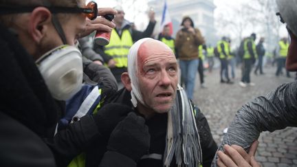 Un "gilet jaune" a été blessé lors des manifestations. (LUCAS BARIOULET / AFP)